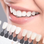 teeth-whitening-charts-sq-150